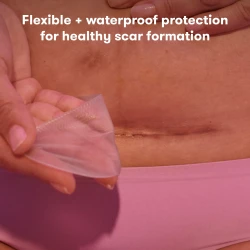 Пластыри для рубца после кесарева сечения Frida Mom Прозрачный купить в Кишиневе. Фото 3